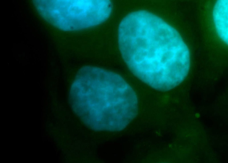Immunofluorescent analysis of HepG2 cells, using RBM41 antibody Catalog No:114613 at 1:100 dilution and FITC-labeled donkey anti-rabbit IgG(green). Blue pseudocolor = DAPI (fluorescent DNA dye).