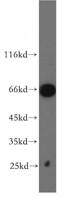 Jurkat cells were subjected to SDS PAGE followed by western blot with Catalog No:115987(TAF5L antibody) at dilution of 1:500