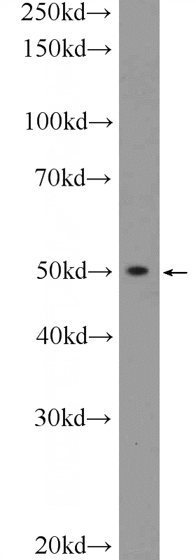 C6 cells were subjected to SDS PAGE followed by western blot with Catalog No:117098(BCL2L13 Antibody) at dilution of 1:600