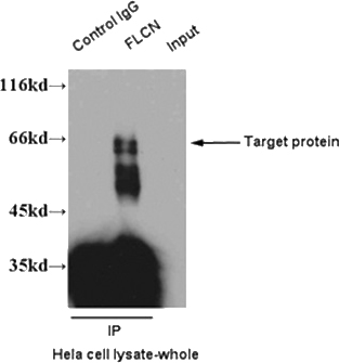 IP result of anti-FLCN(Catalog No:110686) with Hela cell.