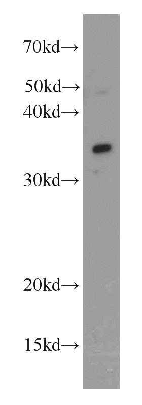 mouse kidney tissue were subjected to SDS PAGE followed by western blot with Catalog No:107857(ALKBH4 antibody) at dilution of 1:500