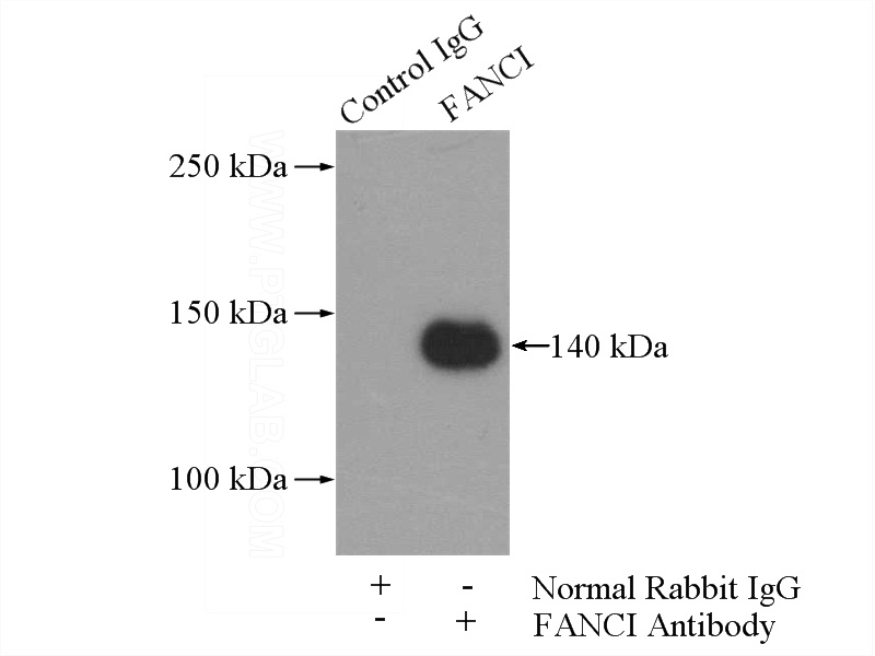 IP Result of anti-FANCI (IP:Catalog No:110520, 4ug; Detection:Catalog No:110520 1:1000) with Jurkat cells lysate 2400ug.
