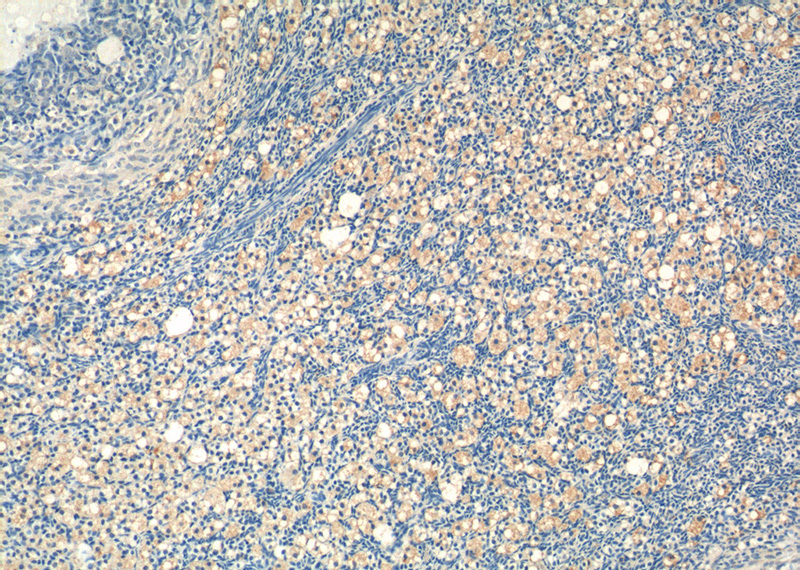 Immunohistochemistry of paraffin-embedded human ovary tissue slide using Catalog No:108334(ATN1 Antibody) at dilution of 1:50 (under 10x lens)