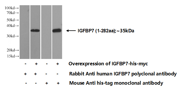 Transfected HEK-293 cells were subjected to SDS PAGE followed by western blot with Catalog No:111689(IGFBP7 Antibody) at dilution of 1:700