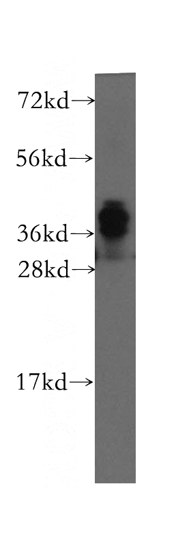 human brain tissue were subjected to SDS PAGE followed by western blot with Catalog No:113058(NDRG4 antibody) at dilution of 1:400