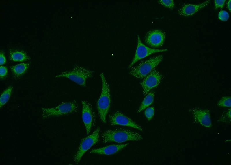 Immunofluorescent analysis of PC-3 cells using Catalog No:112542(MCC Antibody) at dilution of 1:25 and Alexa Fluor 488-congugated AffiniPure Goat Anti-Rabbit IgG(H+L)