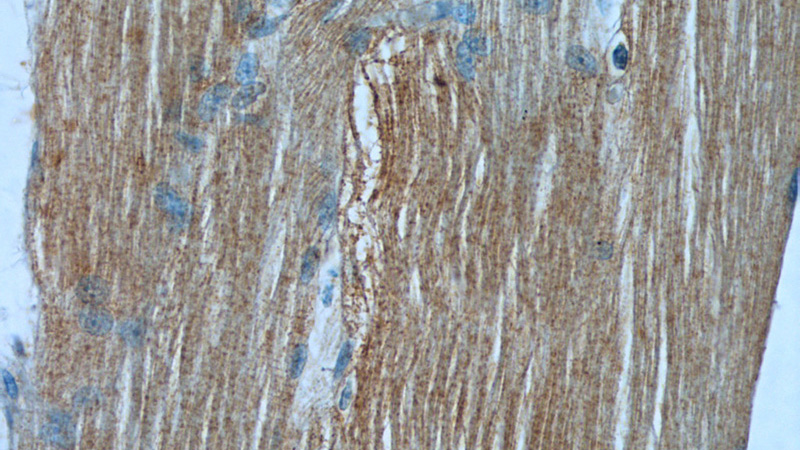 Immunohistochemistry of paraffin-embedded human skeletal muscle tissue slide using Catalog No:112508(MBNL3 Antibody) at dilution of 1:50 (under 40x lens)