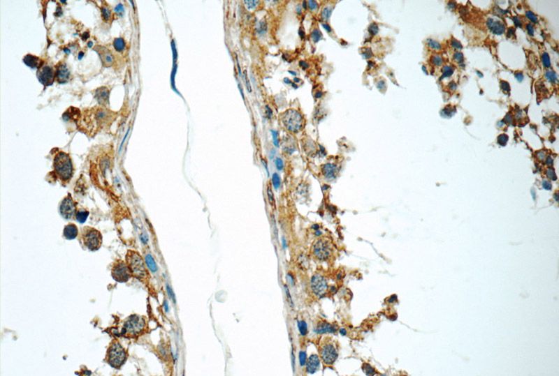 Immunohistochemistry of paraffin-embedded human testis tissue slide using Catalog No:115343(C20orf54 Antibody) at dilution of 1:50 (under 40x lens)