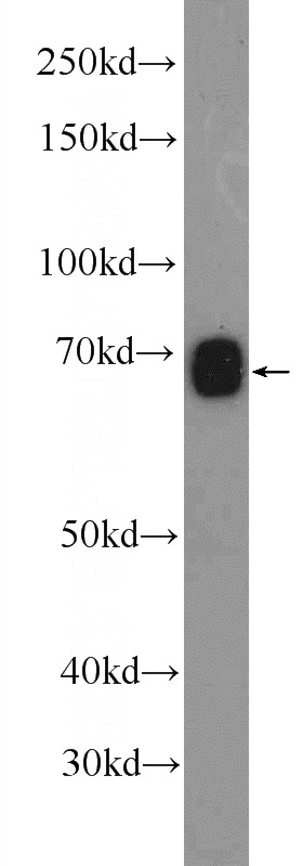 mouse liver tissue were subjected to SDS PAGE followed by western blot with Catalog No:111987(KIAA0907 Antibody) at dilution of 1:300