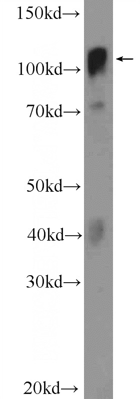 MCF-7 cells were subjected to SDS PAGE followed by western blot with Catalog No:116893(YTHDC1 Antibody) at dilution of 1:300