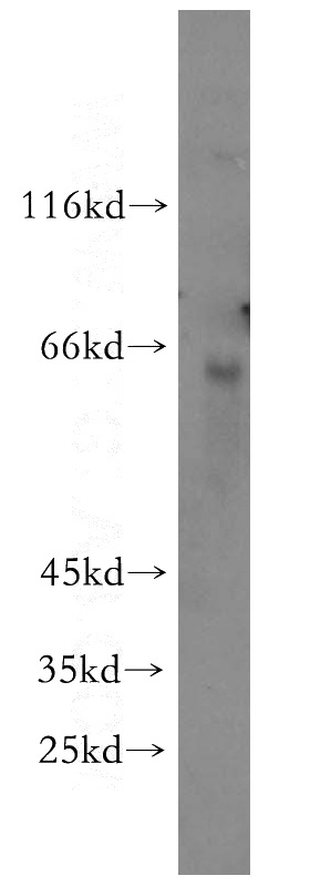 mouse liver tissue were subjected to SDS PAGE followed by western blot with Catalog No:112122(KRBP antibody) at dilution of 1:300
