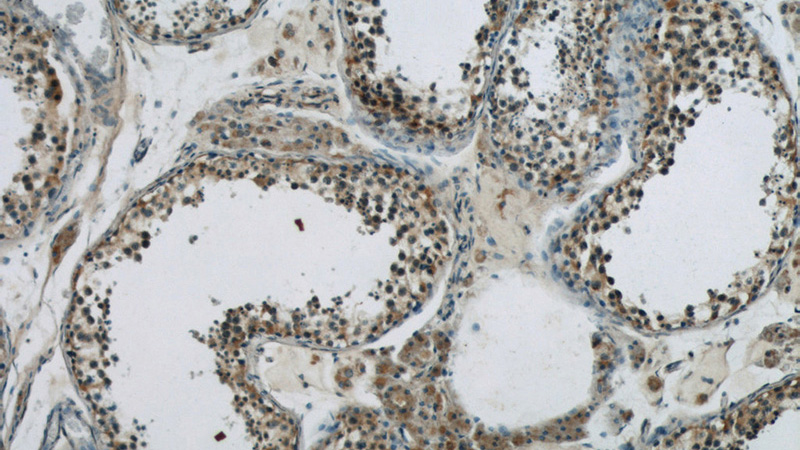 Immunohistochemistry of paraffin-embedded human testis slide using Catalog No:115861(TBC1D1 Antibody) at dilution of 1:50
