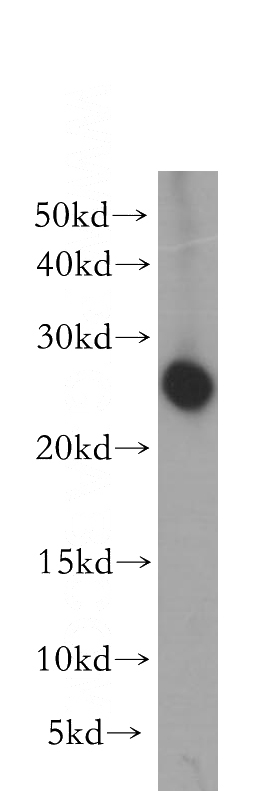 mouse uterus tissue were subjected to SDS PAGE followed by western blot with Catalog No:111181(GSTA3 antibody) at dilution of 1:400