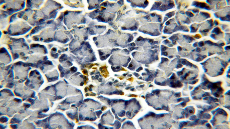 Immunohistochemical of paraffin-embedded human pancreas using Catalog No:115365(SLC30A8-Specific antibody) at dilution of 1:50 (under 40x lens)