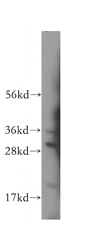 U-937 cells were subjected to SDS PAGE followed by western blot with Catalog No:112404(LY96 antibody) at dilution of 1:400