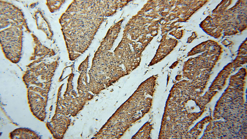 Immunohistochemical of paraffin-embedded human heart using Catalog No:116775(VPS24 antibody) at dilution of 1:50 (under 10x lens)