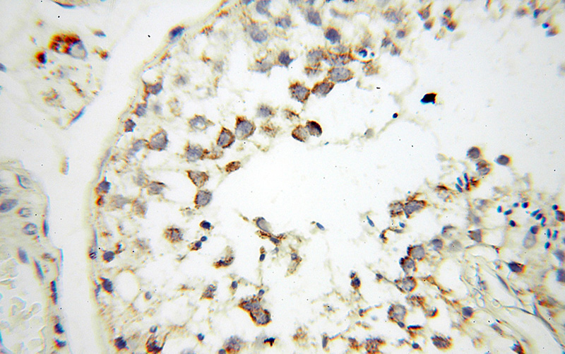 Immunohistochemical of paraffin-embedded human testis using Catalog No:109329(KIT antibody) at dilution of 1:400 (under 40x lens)