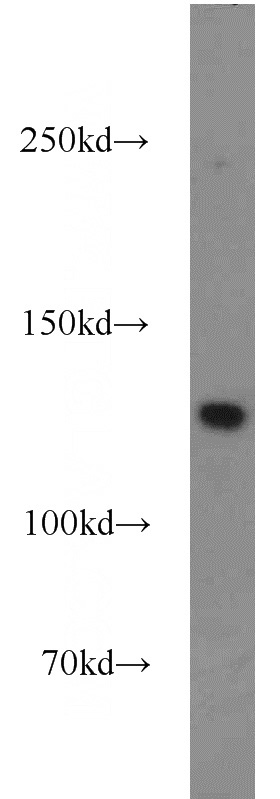 HeLa cells were subjected to SDS PAGE followed by western blot with Catalog No:112868(MSH3 antibody) at dilution of 1:1000