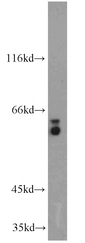PC-3 cells were subjected to SDS PAGE followed by western blot with Catalog No:114290(PSAP antibody) at dilution of 1:800