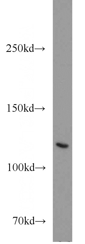mouse lung tissue were subjected to SDS PAGE followed by western blot with Catalog No:109990(SAP 97 antibody) at dilution of 1:300