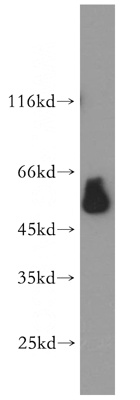 human spleen tissue were subjected to SDS PAGE followed by western blot with Catalog No:110480(ESRRG antibody) at dilution of 1:1000