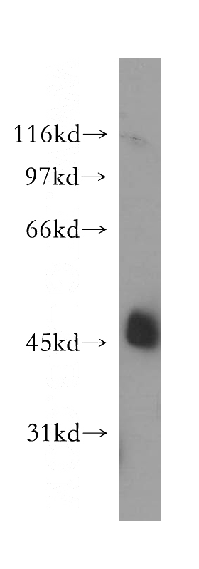 A375 cells were subjected to SDS PAGE followed by western blot with Catalog No:115730(STOML1 antibody) at dilution of 1:300