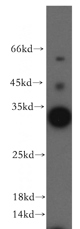 human brain tissue were subjected to SDS PAGE followed by western blot with Catalog No:111262(HAUS4 antibody) at dilution of 1:500