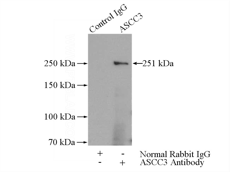 IP Result of anti-ASCC3 (IP:Catalog No:108220, 4ug; Detection:Catalog No:108220 1:400) with HeLa cells lysate 1080ug.