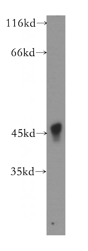 mouse pancreas tissue were subjected to SDS PAGE followed by western blot with Catalog No:107716(ACAD8 antibody) at dilution of 1:500