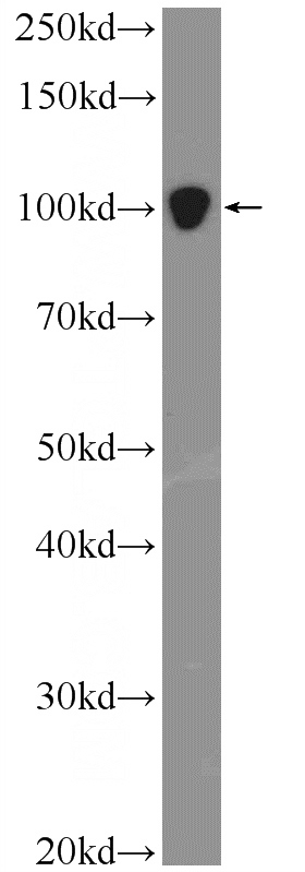 HeLa cells were subjected to SDS PAGE followed by western blot with Catalog No:109906(DGCR8 Antibody) at dilution of 1:600
