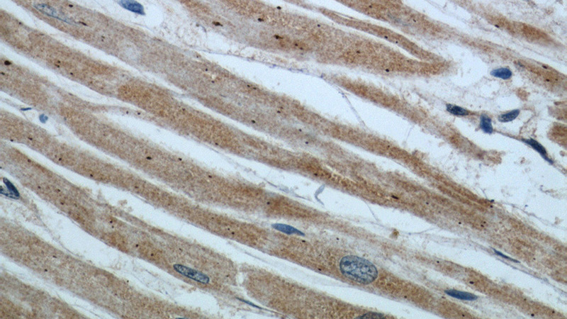 Immunohistochemical of paraffin-embedded human heart using Catalog No:113364(NUDT9 antibody) at dilution of 1:50 (under 40x lens)