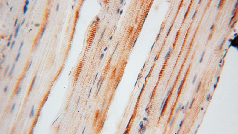 Immunohistochemical of paraffin-embedded human skeletal muscle using Catalog No:110614(FEM1A antibody) at dilution of 1:50 (under 40x lens)