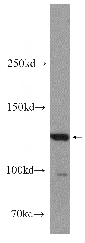 mouse brain tissue were subjected to SDS PAGE followed by western blot with Catalog No:108414(BAIAP3 Antibody) at dilution of 1:300