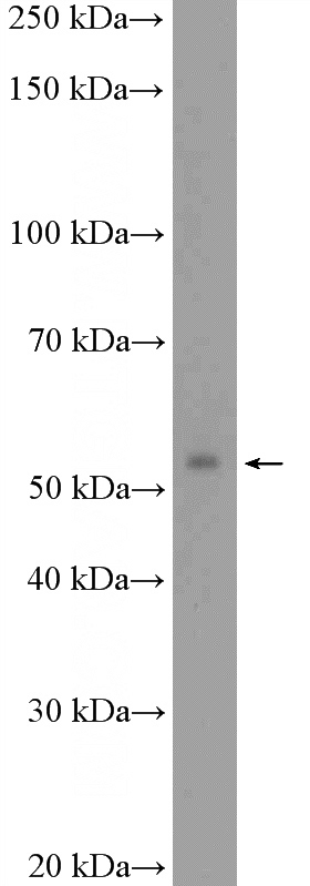 rat kidney tissue were subjected to SDS PAGE followed by western blot with Catalog No:115151(SFRS6 Antibody) at dilution of 1:600