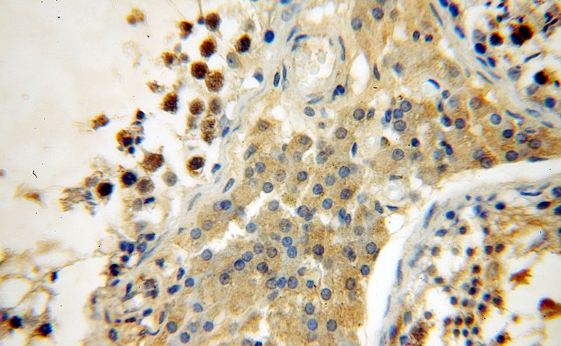 Immunohistochemical of paraffin-embedded human testis using Catalog No:115757(SYCE1 antibody) at dilution of 1:100 (under 40x lens)