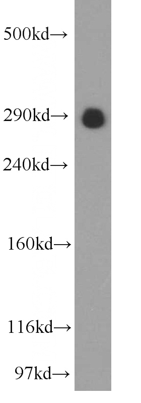 HEK-293 cells were subjected to SDS PAGE followed by western blot with Catalog No:116692(USP9X antibody) at dilution of 1:500