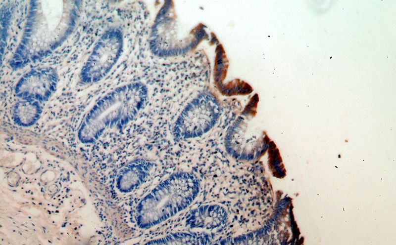 Immunohistochemical of paraffin-embedded human colon using Catalog No:113758(PCYOX1 antibody) at dilution of 1:50 (under 10x lens)