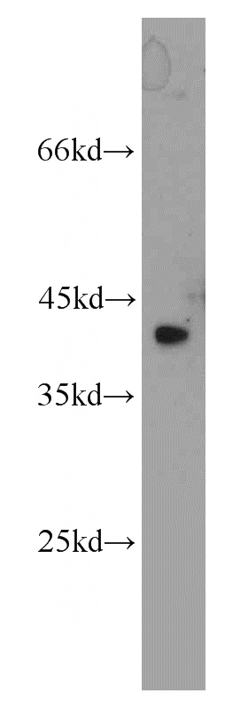 HeLa cells were subjected to SDS PAGE followed by western blot with Catalog No:116964(ZNF24 antibody) at dilution of 1:800