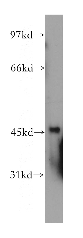 mouse pancreas tissue were subjected to SDS PAGE followed by western blot with Catalog No:108328(ATX3,ATXN3 antibody) at dilution of 1:500