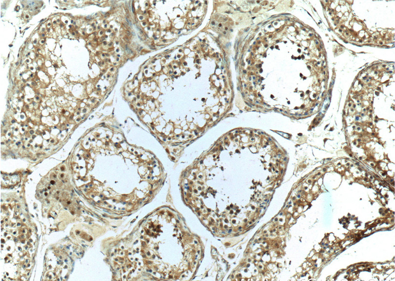 Immunohistochemistry of paraffin-embedded human testis tissue slide using Catalog No:108983(CCDC62 Antibody) at dilution of 1:50 (under 10x lens)