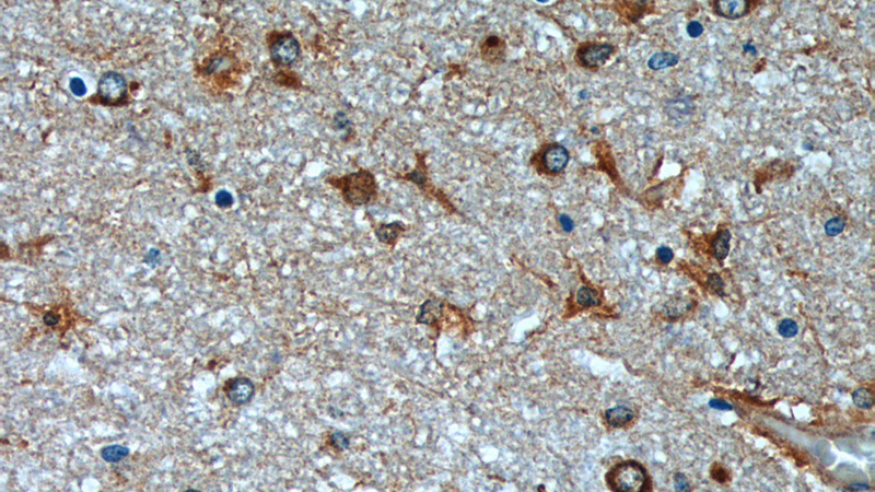 Immunohistochemistry of paraffin-embedded human brain tissue slide using Catalog No:110964(GHDC Antibody) at dilution of 1:200 (under 40x lens)