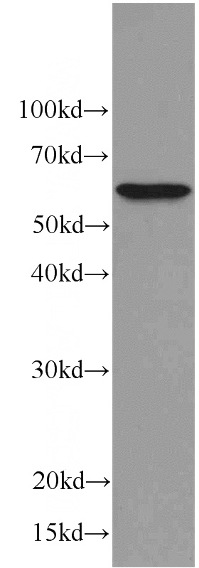 human brain tissue were subjected to SDS PAGE followed by western blot with Catalog No:107029(C9orf72 antibody) at dilution of 1:1000
