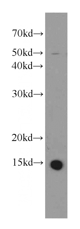 HEK-293 cells were subjected to SDS PAGE followed by western blot with Catalog No:108316(ATP6V1G3 antibody) at dilution of 1:500