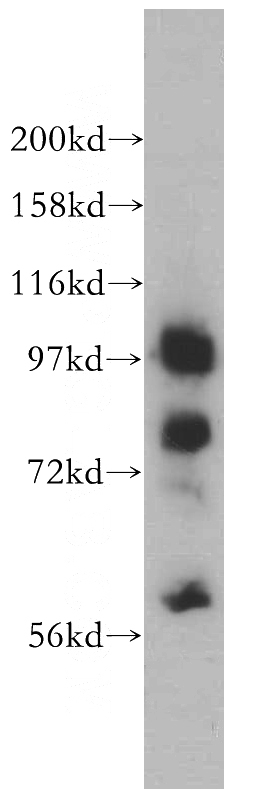 HepG2 cells were subjected to SDS PAGE followed by western blot with Catalog No:112482(MARS antibody) at dilution of 1:2000