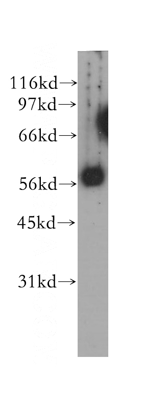 mouse ovary tissue were subjected to SDS PAGE followed by western blot with Catalog No:109086(CCT6B antibody) at dilution of 1:500