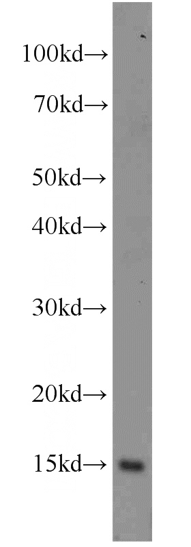 Jurkat cells were subjected to SDS PAGE followed by western blot with Catalog No:115179(SH2D1B antibody) at dilution of 1:800