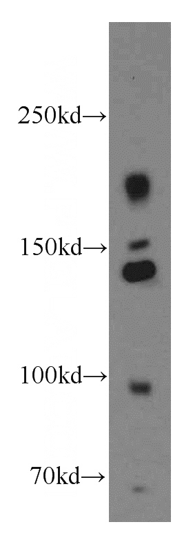 HEK-293 cells were subjected to SDS PAGE followed by western blot with Catalog No:111851(INSR antibody) at dilution of 1:500