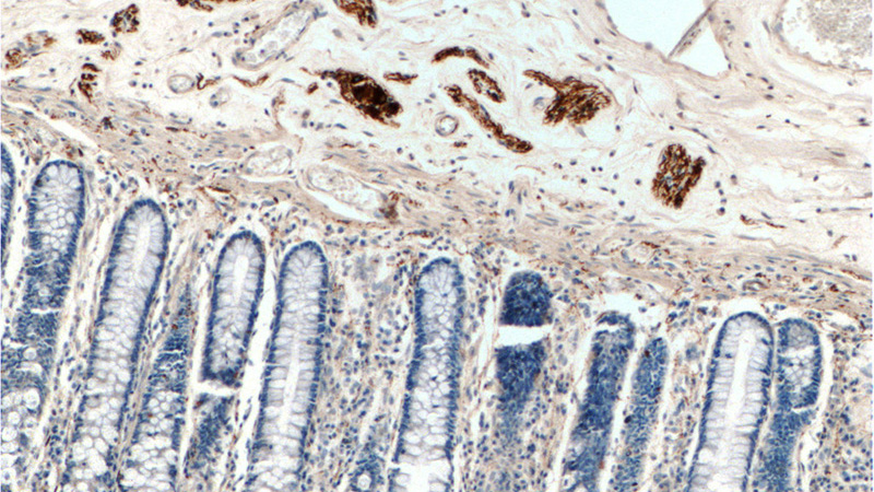 Immunohistochemistry of paraffin-embedded human colon tissue slide using Catalog No:113716(Peripherin Antibody) at dilution of 1:50 (under 10x lens)