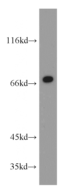 Jurkat cells were subjected to SDS PAGE followed by western blot with Catalog No:110379(SELE antibody) at dilution of 1:300