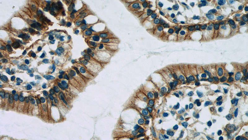 Immunohistochemistry of paraffin-embedded human small intestine tissue slide using Catalog No:111077(SLC2A2 Antibody) at dilution of 1:50 (under 40x lens)